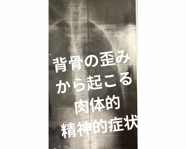 背骨の歪み、心身共に危険！　鶴橋のカイロ整体　
