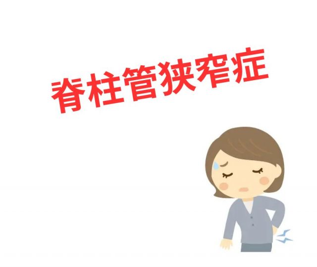 脊柱管狭窄症｜手術以外で改善する方法とは？